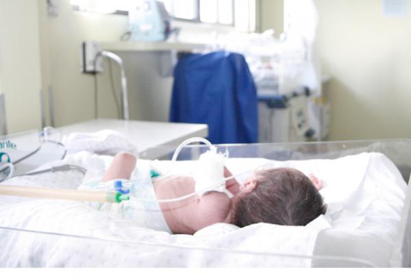 Cesáreas aumentam nascimentos prematuros no Brasil, aponta estudo realizado em Pelotas