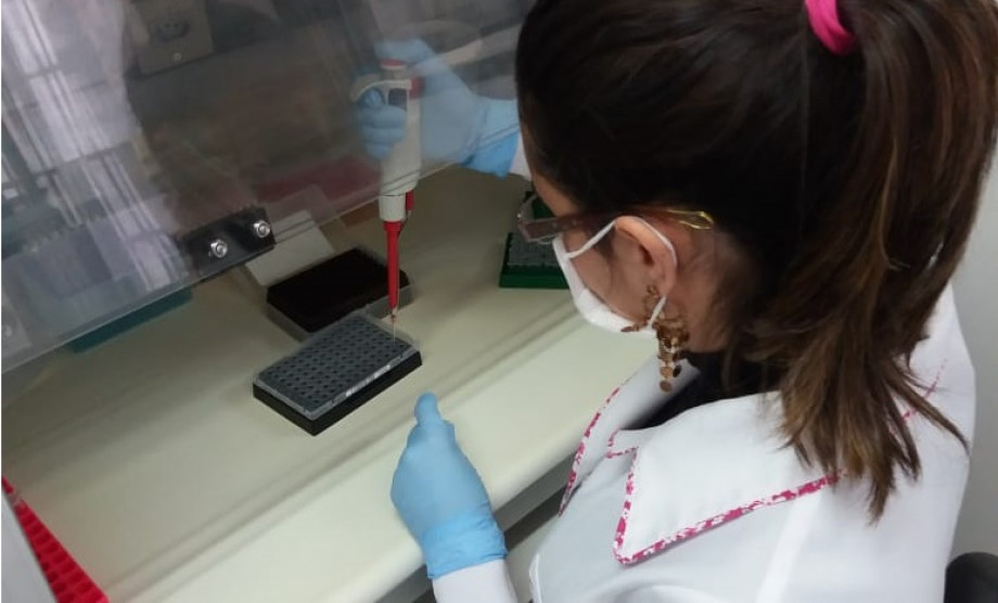 UCPel adquire insumos para realização dos exames de coronavírus